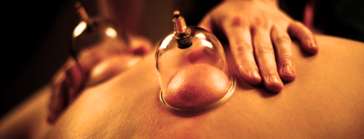 both wet and dry cupping can be effective in improving circulation in certain body areas and promote self healing